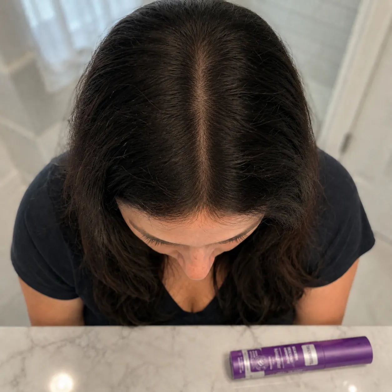 Hair after eight weeks, fuller and lifted at the roots